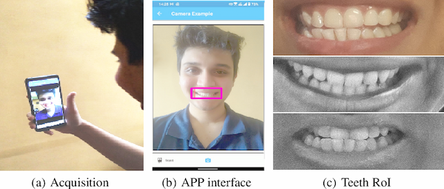 Figure 1 for DeepTeeth: A Teeth-photo Based Human Authentication System for Mobile and Hand-held Devices