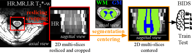 Figure 2 for 2D Multi-Class Model for Gray and White Matter Segmentation of the Cervical Spinal Cord at 7T