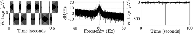 Figure 1 for Searching for waveforms on spatially-filtered epileptic ECoG