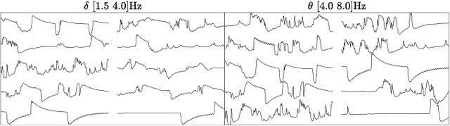 Figure 4 for Searching for waveforms on spatially-filtered epileptic ECoG