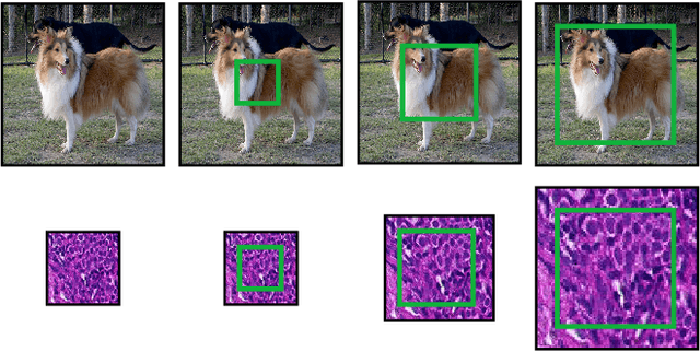 Figure 1 for Understanding the impact of image and input resolution on deep digital pathology patch classifiers