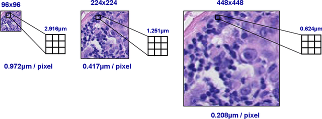 Figure 3 for Understanding the impact of image and input resolution on deep digital pathology patch classifiers