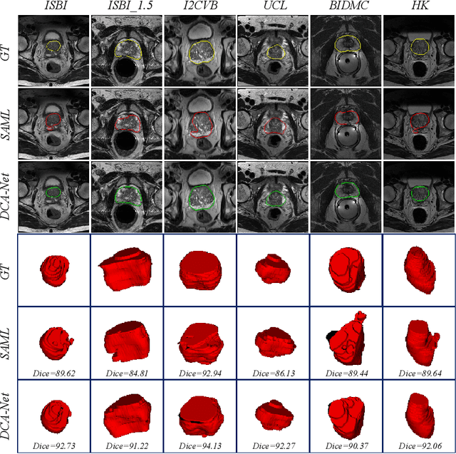 Figure 3 for Domain Composition and Attention for Unseen-Domain Generalizable Medical Image Segmentation
