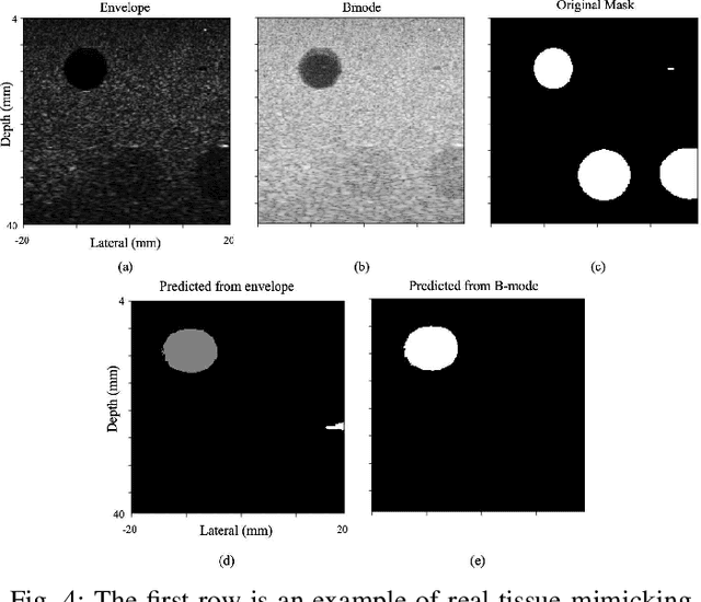 Figure 4 for Ultrasound segmentation using U-Net: learning from simulated data and testing on real data