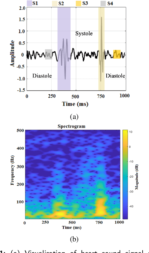 Figure 1 for Time-Frequency Distributions of Heart Sound Signals: A Comparative Study using Convolutional Neural Networks
