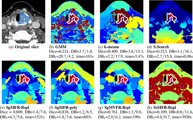 Figure 1 for Spectral image clustering on dual-energy CT scans using functional regression mixtures