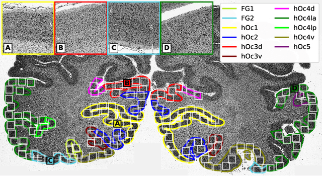 Figure 1 for Contrastive Representation Learning for Whole Brain Cytoarchitectonic Mapping in Histological Human Brain Sections