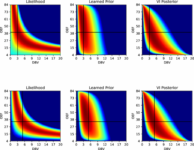 Figure 1 for Flexible Amortized Variational Inference in qBOLD MRI