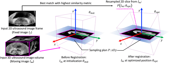 Figure 1 for End-to-end Ultrasound Frame to Volume Registration