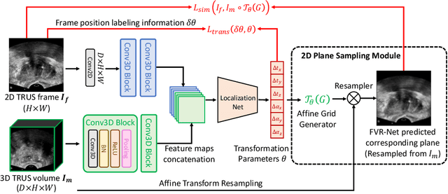 Figure 3 for End-to-end Ultrasound Frame to Volume Registration