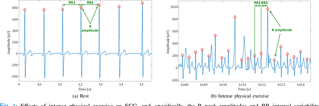 Figure 1 for Adaptive R-Peak Detection on Wearable ECG Sensors for High-Intensity Exercise