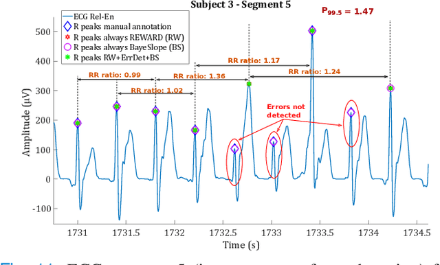 Figure 2 for Adaptive R-Peak Detection on Wearable ECG Sensors for High-Intensity Exercise