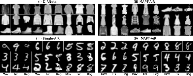 Figure 3 for Attention for Image Registration (AiR): an unsupervised Transformer approach