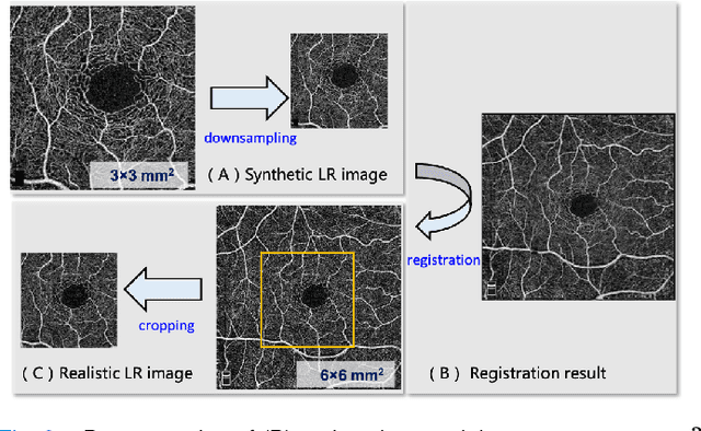 Figure 2 for Sparse-based Domain Adaptation Network for OCTA Image Super-Resolution Reconstruction