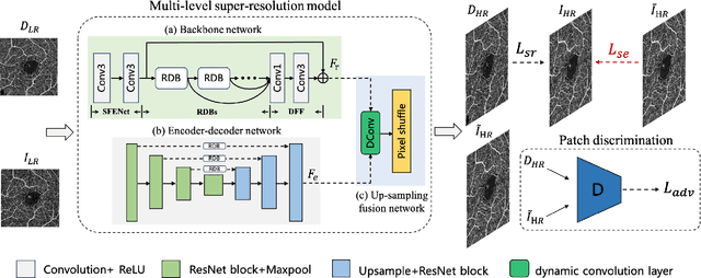 Figure 3 for Sparse-based Domain Adaptation Network for OCTA Image Super-Resolution Reconstruction