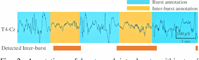 Figure 2 for Tracé alternant detector for grading hypoxic-ischemic encephalopathy in neonatal EEG