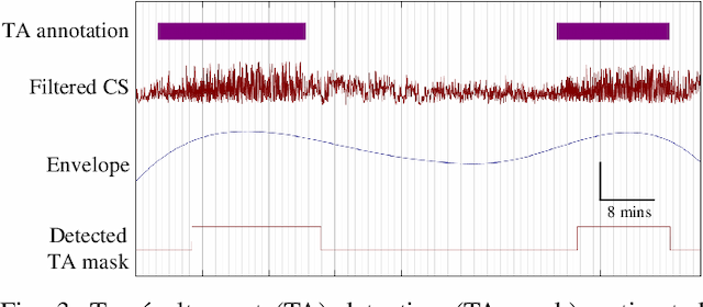 Figure 3 for Tracé alternant detector for grading hypoxic-ischemic encephalopathy in neonatal EEG