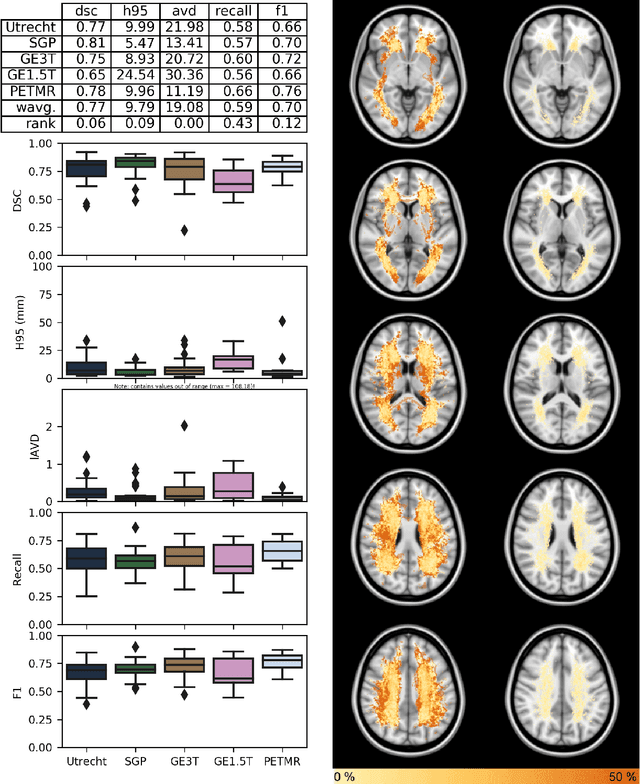 Figure 4 for Standardized Assessment of Automatic Segmentation of White Matter Hyperintensities and Results of the WMH Segmentation Challenge