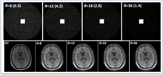 Figure 1 for An untrained deep learning method for reconstructing dynamic magnetic resonance images from accelerated model-based data