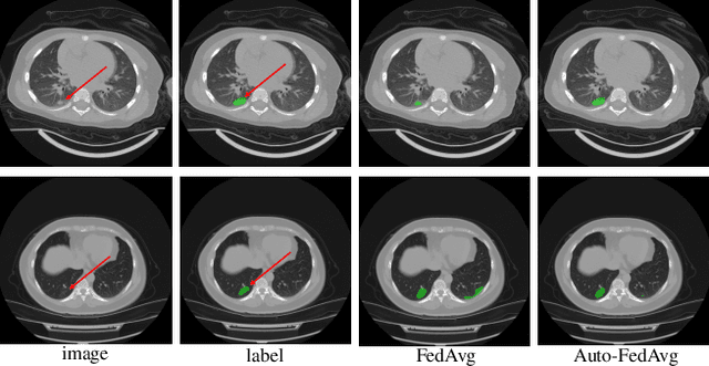 Figure 4 for Auto-FedAvg: Learnable Federated Averaging for Multi-Institutional Medical Image Segmentation