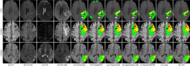 Figure 3 for CKD-TransBTS: Clinical Knowledge-Driven Hybrid Transformer with Modality-Correlated Cross-Attention for Brain Tumor Segmentation