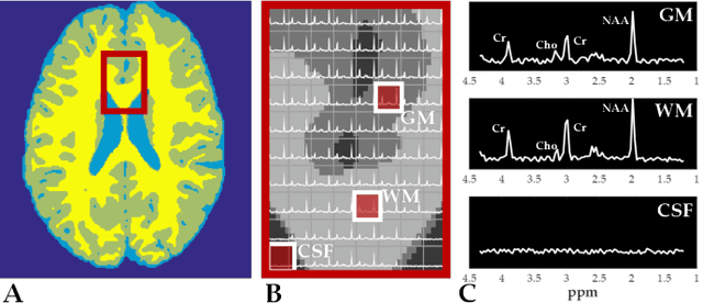 Figure 1 for Qunatification of Metabolites in MR Spectroscopic Imaging using Machine Learning