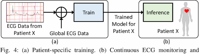 Figure 4 for LSTM-Based ECG Classification for Continuous Monitoring on Personal Wearable Devices