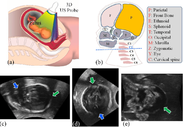 Figure 1 for Hybrid Attention for Automatic Segmentation of Whole Fetal Head in Prenatal Ultrasound Volumes