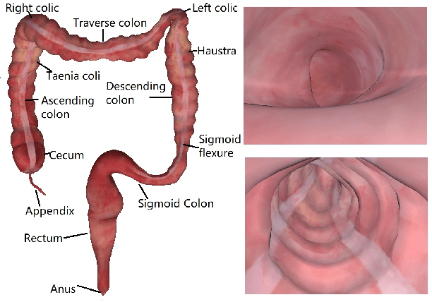 Figure 1 for Combining Deep Learning with Geometric Features for Image based Localization in the Gastrointestinal Tract