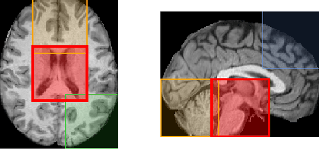 Figure 4 for Patch-based Brain Age Estimation from MR Images