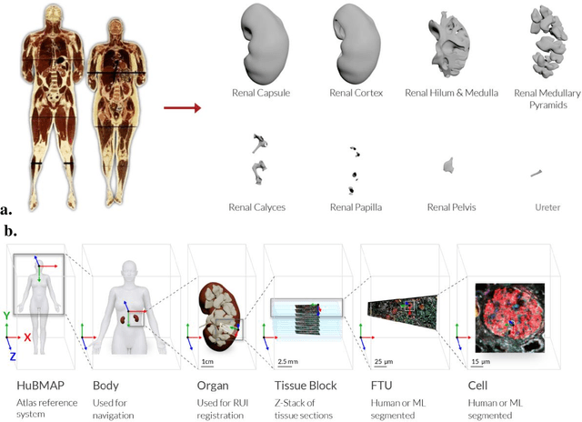 Figure 3 for Construction and Usage of a Human Body Common Coordinate Framework Comprising Clinical, Semantic, and Spatial Ontologies