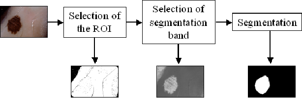 Figure 1 for Segmenting Dermoscopic Images