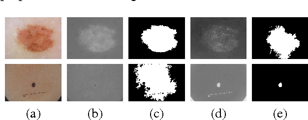 Figure 3 for Segmenting Dermoscopic Images