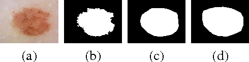 Figure 4 for Segmenting Dermoscopic Images
