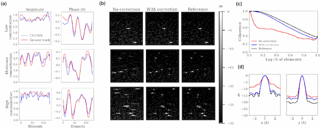Figure 4 for Phase Aberration Correction for in vivo Ultrasound Localization Microscopy Using a Spatiotemporal Complex-Valued Neural Network