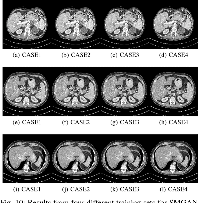 Figure 2 for Structure-sensitive Multi-scale Deep Neural Network for Low-Dose CT Denoising