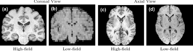 Figure 1 for Deep Learning for Low-Field to High-Field MR: Image Quality Transfer with Probabilistic Decimation Simulator