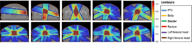 Figure 1 for Using Deep Learning to Predict Beam-Tunable Pareto Optimal Dose Distribution for Intensity Modulated Radiation Therapy