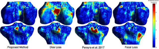 Figure 2 for Distance Map Loss Penalty Term for Semantic Segmentation