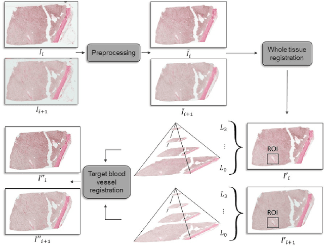 Figure 4 for Regional Registration of Whole Slide Image Stacks Containing Highly Deformed Artefacts