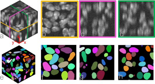 Figure 3 for YOLO2U-Net: Detection-Guided 3D Instance Segmentation for Microscopy