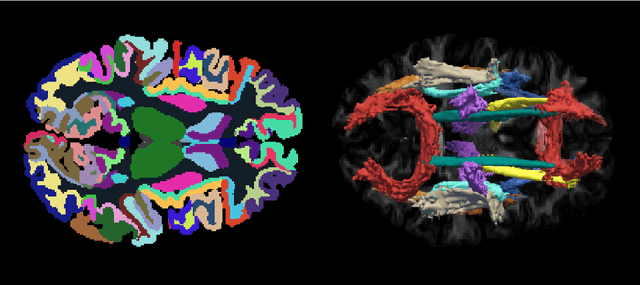 Figure 1 for Learning Anatomical Segmentations for Tractography from Diffusion MRI