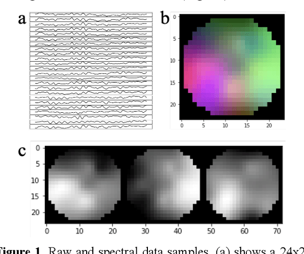Figure 2 for Deep Convolutional Neural Network Applied to Electroencephalography: Raw Data vs Spectral Features