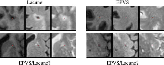 Figure 1 for 3D multirater RCNN for multimodal multiclass detection and characterisation of extremely small objects
