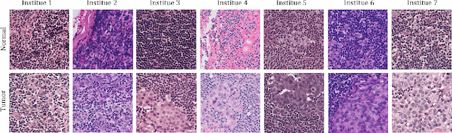 Figure 1 for Neural Stain-Style Transfer Learning using GAN for Histopathological Images