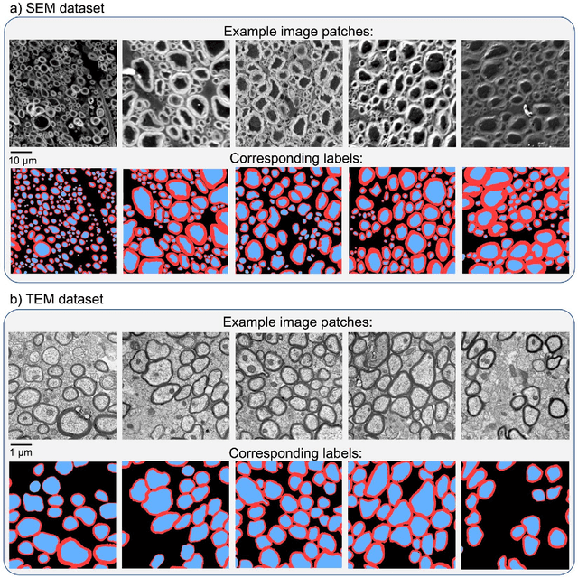Figure 1 for AxonDeepSeg: automatic axon and myelin segmentation from microscopy data using convolutional neural networks