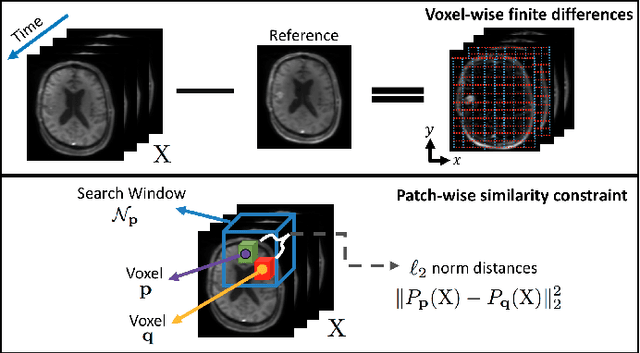 Figure 1 for Accelerated Reconstruction of Perfusion-Weighted MRI Enforcing Jointly Local and Nonlocal Spatio-temporal Constraints