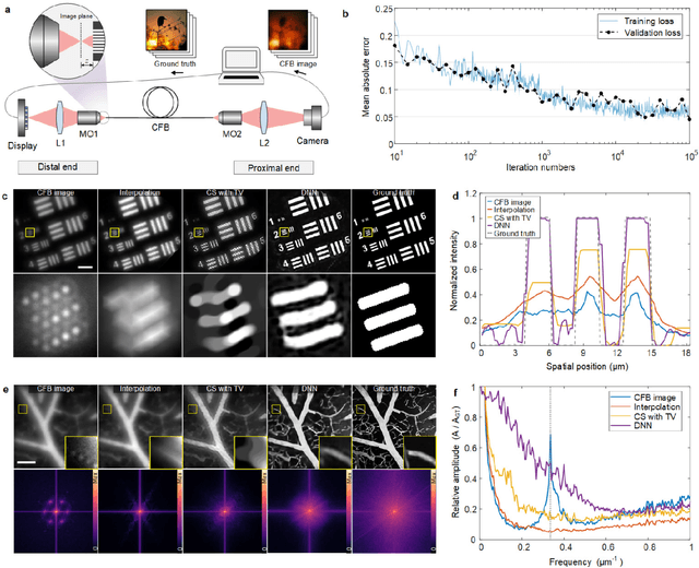 Figure 4 for Learned end-to-end high-resolution lensless fiber imaging toward intraoperative real-time cancer diagnosis