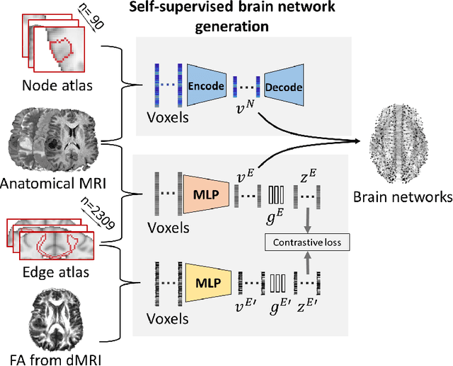 Figure 3 for Multi-modal learning for predicting the genotype of glioma