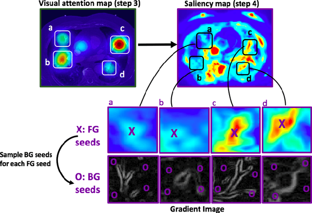 Figure 3 for Gaze2Segment: A Pilot Study for Integrating Eye-Tracking Technology into Medical Image Segmentation